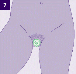 female_condom_-_how_to_use_7